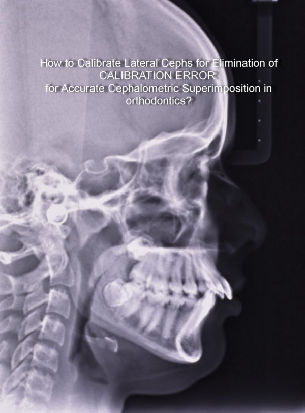 How to Calibrate Lateral Cephalogram Manually