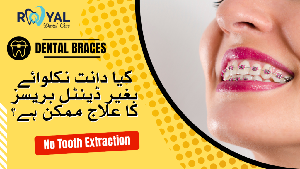 Is Dental Braces Treatment Possible Without Tooth Extraction? - Royal ...