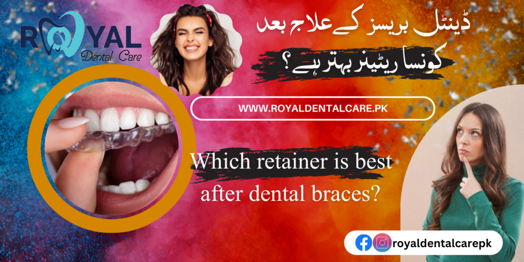 Which retainer is best after dental braces