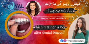 Which retainer is best after dental braces